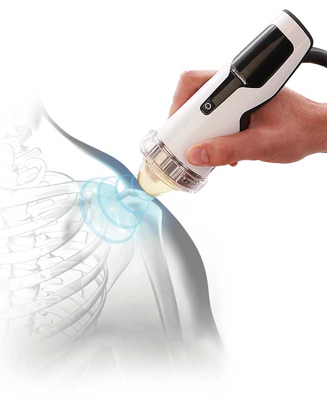 Focused Shockwave Therapy